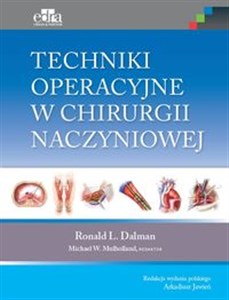 Bild von Techniki operacyjne w chirurgii naczyniowej