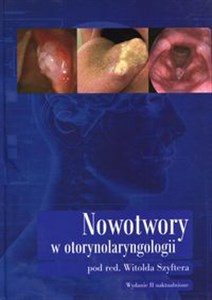 Bild von Nowotwory w otorynolaryngologii