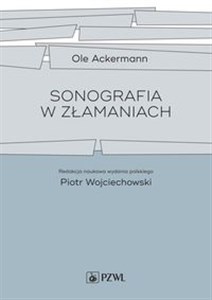 Obrazek Sonografia w złamaniach