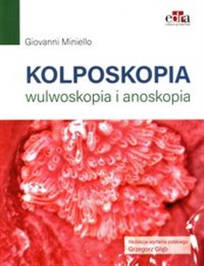 Bild von Kolposkopia, wulwoskopia i anoskopia