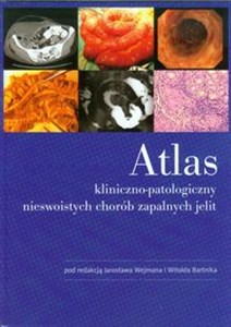 Bild von Atlas kliniczno-patologiczny nieswoistych chorób zapalnych jelit
