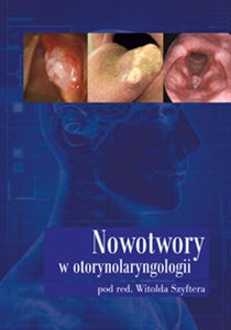 Bild von Nowotwory w otorynolaryngologii