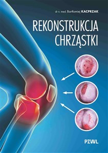 Obrazek Rekonstrukcja chrząstki Ratujemy kolano, nie wymieniamy