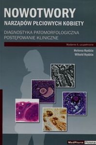 Bild von Nowotwory narządów płciowych kobiety Diagnostyka patomorfologiczna postępowanie kliniczne