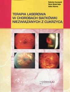 Obrazek Terapia laserowa w chorobach siatkówki niezwiązanych z cukrzycą