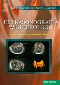 Bild von Ultrasonografia w ginekologii