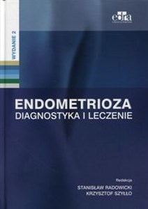 Bild von Endometrioza Diagnostyka i leczenie