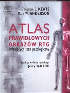 Obrazek Atlas prawidłowych  obrazów RTG imitujących stan patologiczny