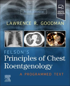 Bild von Felson's Principles of Chest Roentgenology