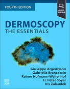 Polnische buch : Dermoscopy... - Giuseppe Argenziano, Gabriella Brancaccio, Rainer Hofmann-Wellenhof