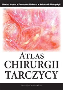 Bild von Atlas chirurgii tarczycy