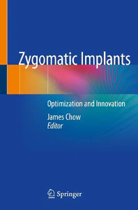 Obrazek ZYGOMATIC IMPLANTS