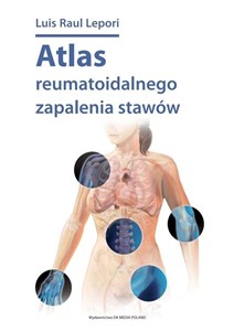 Bild von Atlas reumatoidalnego zapalenia stawów / DK Media