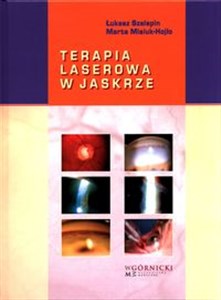 Obrazek Terapia laserowa w jaskrze