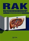 Polska książka : Rak wątrob...