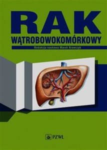 Bild von Rak wątrobowokomórkowy