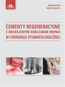 Bild von Cementy regeneracyjne z dwufazowym siarczanem wapnia w chirurgii stomatologicznej