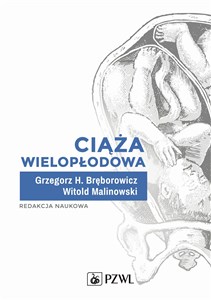 Bild von Ciąża wielopłodowa