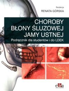 Obrazek Choroby błony śluzowej jamy ustnej