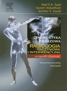 Obrazek Radiologia naczyniowa i interwencyjna Przypadki kliniczne