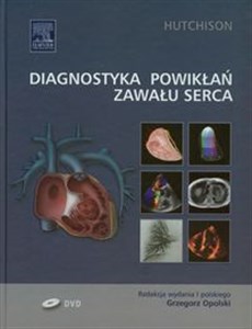 Obrazek Diagnostyka powikłań zawału serca