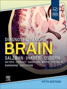 Polska książka : Diagnostic... - Karen Salzman, Miral D. Jhaveri
