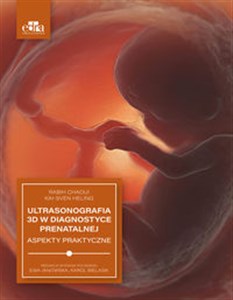 Bild von Ultrasonografia 3D w diagnostyce prenatalnej