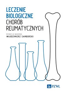 Bild von Leczenie biologiczne chorób reumatycznych