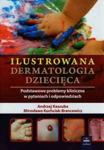 Obrazek Ilustrowana dermatologia dziecięca Podstawowe problemy kliniczne w pytaniach i odpowiedziach