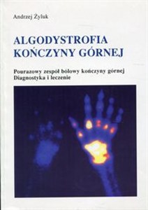 Obrazek Algodystrofia kończyny górnej Pourazowy zespół bólowy kończyny górnej. Diagnostyka i leczenie