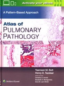 Bild von Atlas of Pulmonary Pathology A Pattern Based Approach, First edition