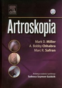 Obrazek Artroskopia