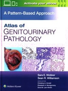 Bild von Atlas of Genitourinary Pathology A Pattern Based Approach, First edition