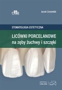 Obrazek Licówki porcelanowe na zęby żuchwy i szczęki Stomatologia estetyczna.