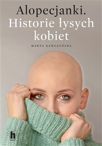 Bild von Alopecjanki Historie łysych kobiet