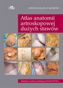 Bild von Atlas anatomii artroskopowej dużych stawów