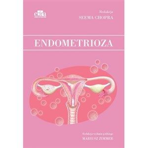 Obrazek Endometrioza