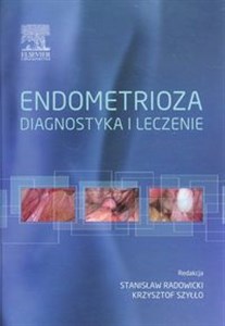 Obrazek Endometrioza diagnostyka i leczenie