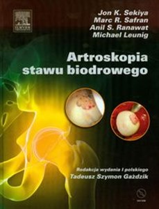 Bild von Artroskopia stawu biodrowego +dvd