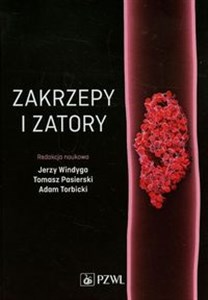 Obrazek Zakrzepy i zatory