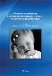 Obrazek Wczesna interwencja i wspomaganie rozwoju u dzieci z chorobami genetycznymi