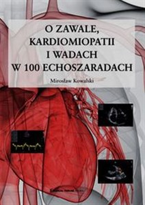 Bild von O zawale kardiomiopatii i wadach w 100 echoszaradach