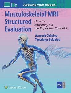 Obrazek Musculoskeletal MRI Structured Evaluation